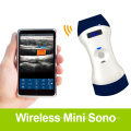 Wifi Probe ultrasound scanner